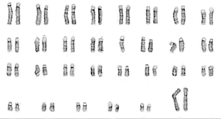 Representative metaphase spread of bovine fibroblasts at passage 44