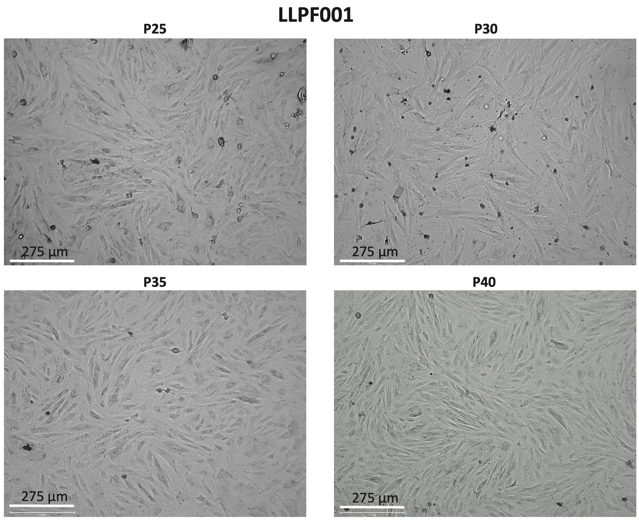 Brightfield images of LLPF001 fibroblast morphology at passages 25, 30, 35 and 40